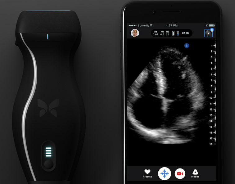 Butterfly iQ Ultrasound On a Chip for iPhone